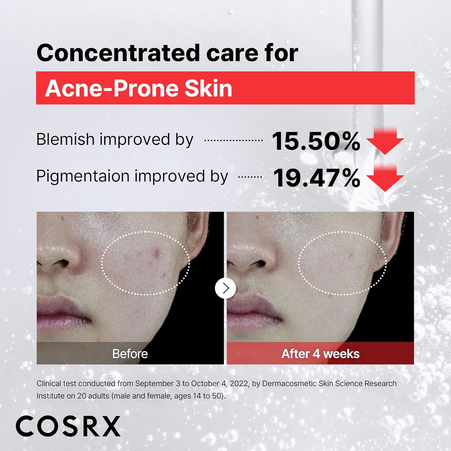 The Niacinamide 15 Serum