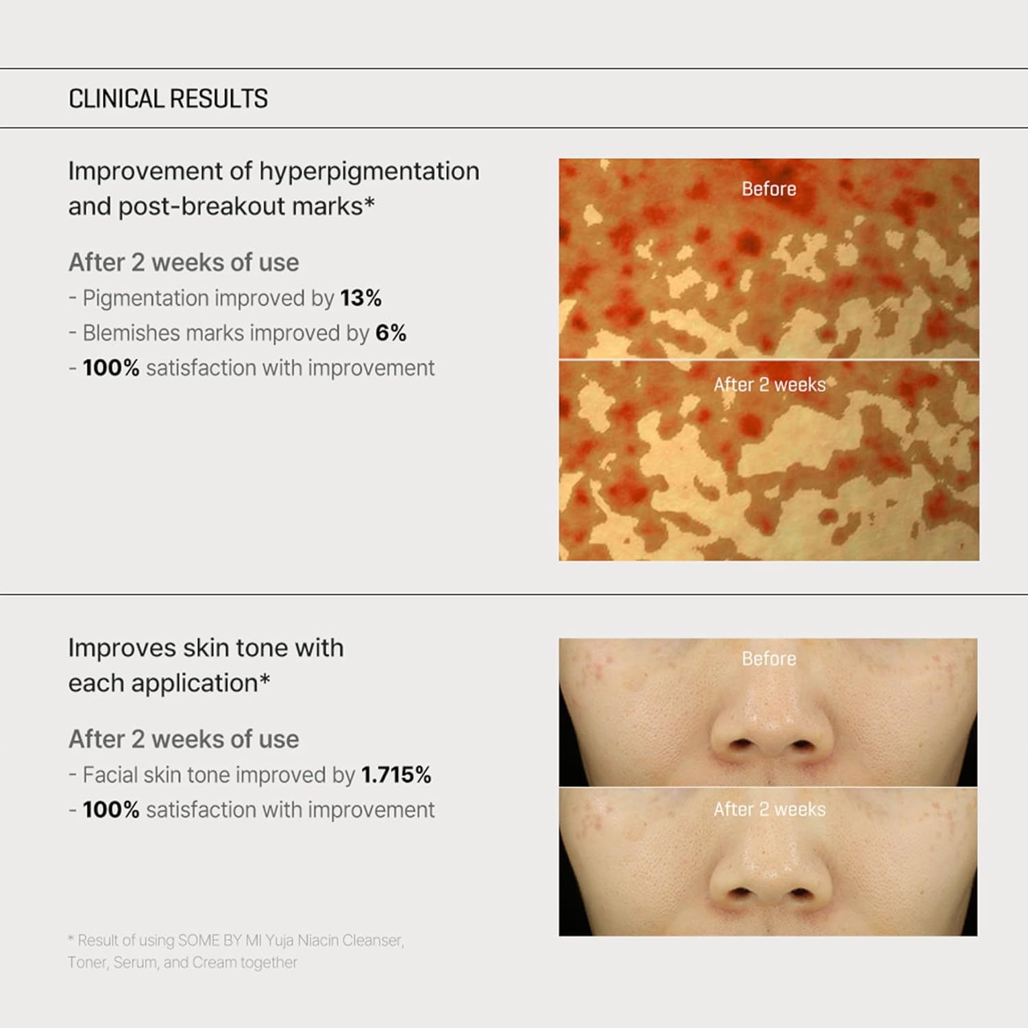 Yuja Niacin Anti Blemish Cream