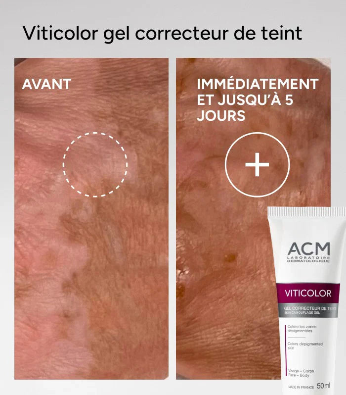 Viticolor Skin Camouflage Gel